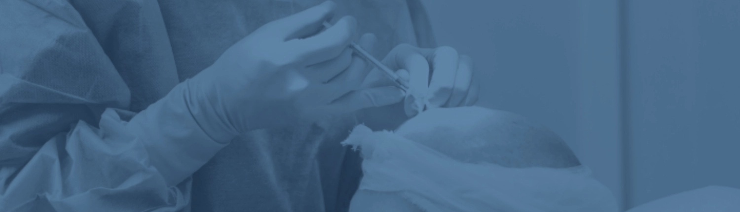 hair transplant malpractice